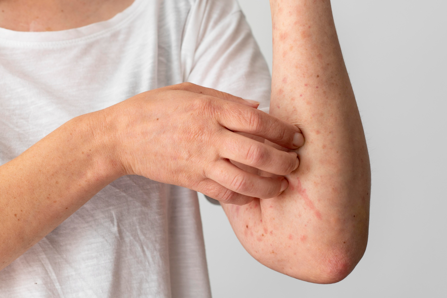 Skin Disorder Care